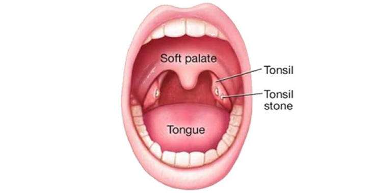 Nasal Congestion