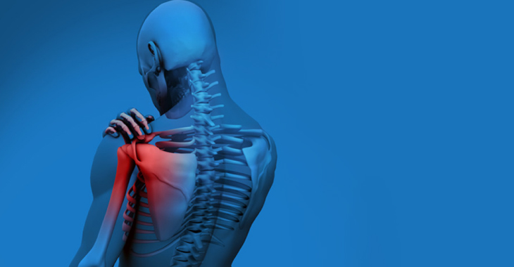 10 Causes of Neck and Shoulder Pain