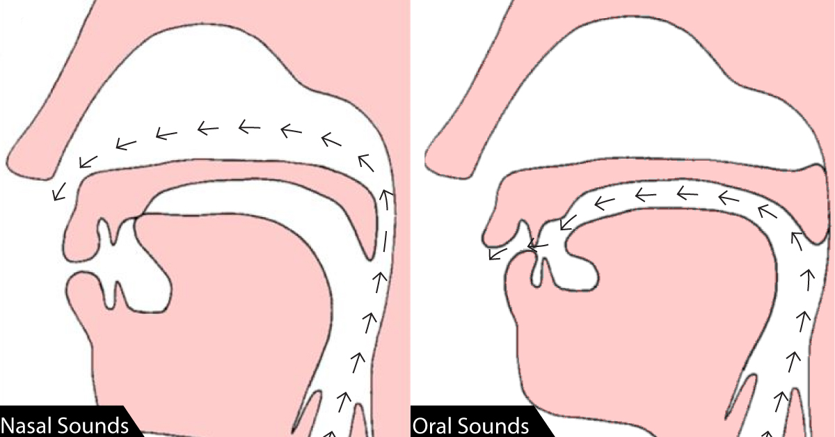 hypernasal speech